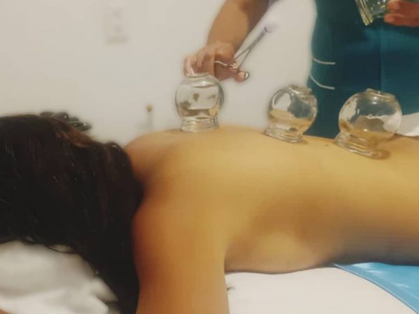 Tratamiento Terapéutico con ventosas